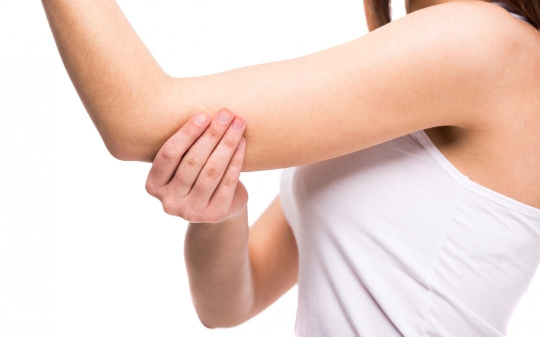 ¿Qué es el linfedema?