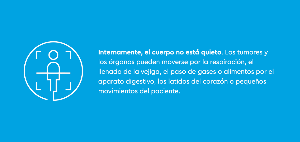 ¿Por qué es importante?