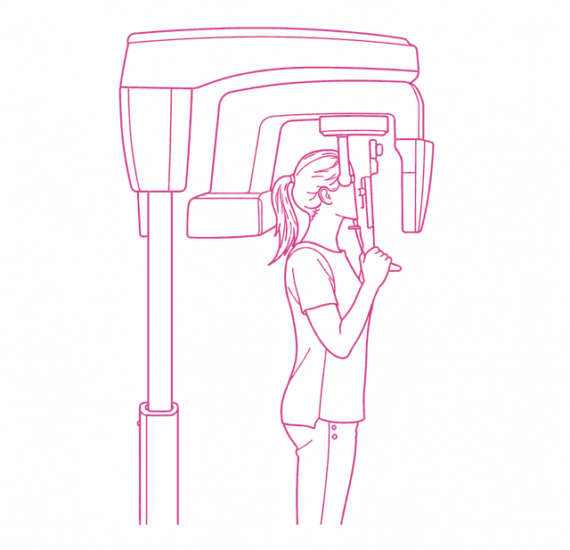 CBCT (escáner 3D integrado en el equipo de radioterapia)