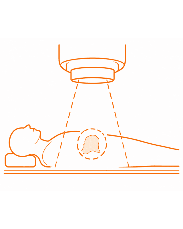 Radioterapia inicial