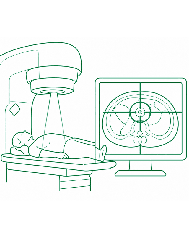Radioterapia guiada por imagen 